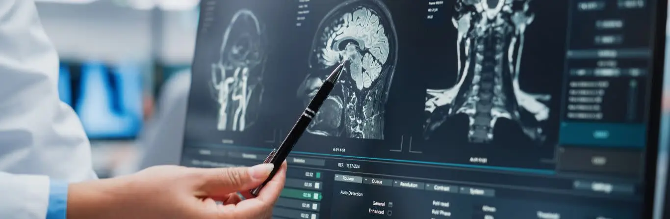 Neurologija